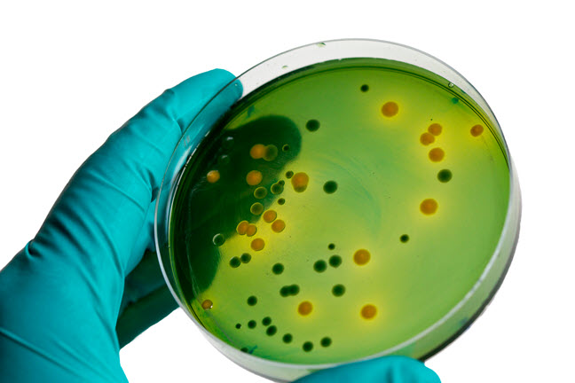 specimens in a petri dish
